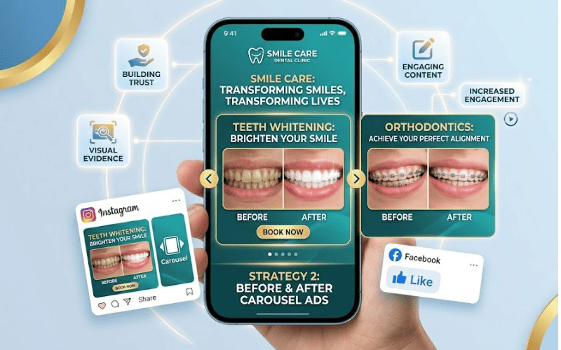 Before & After Carousel Ads